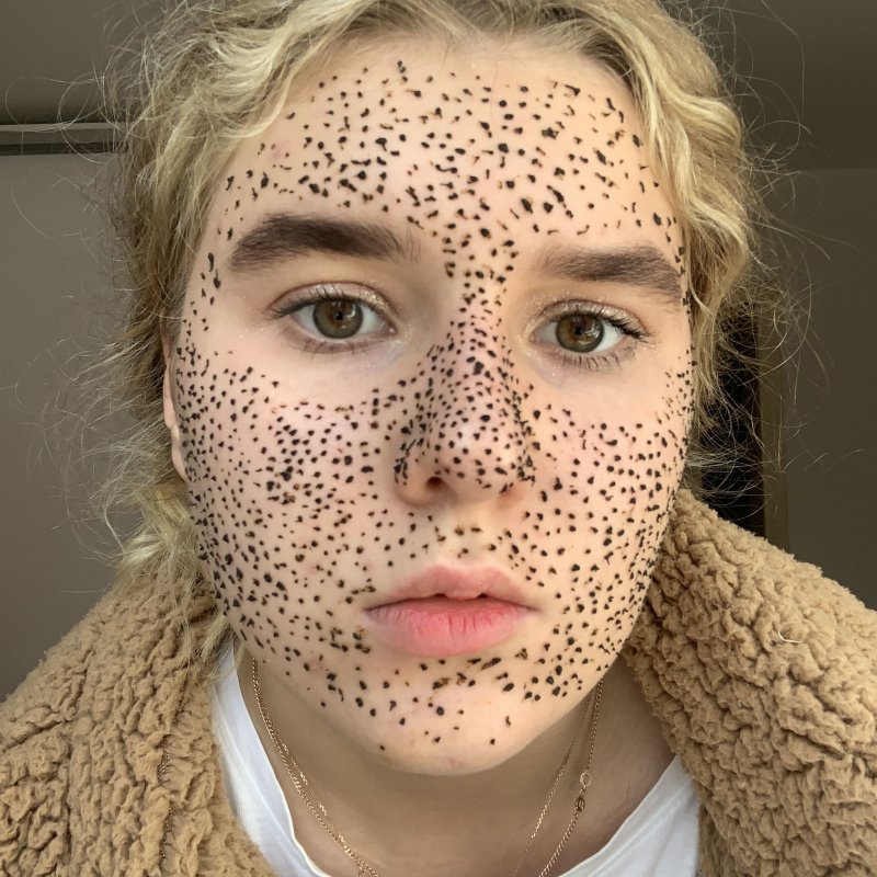 Незаметные веснушки