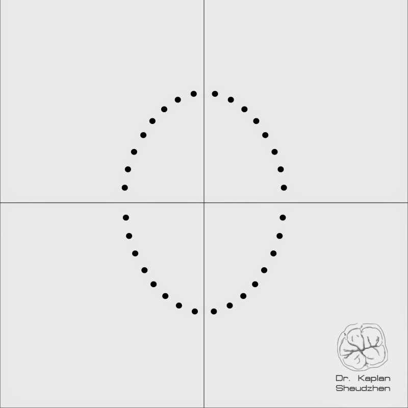 Шаблон для коффердама 15 на 15