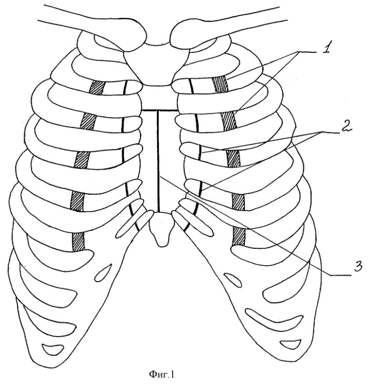 Грудная клетка схематически