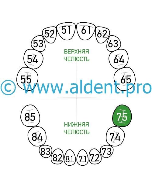 Шаблон для коффердама