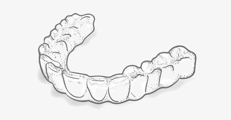 Ортодонтические каппы элайнеры